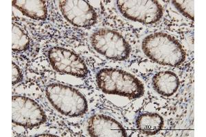 Immunoperoxidase of monoclonal antibody to CHD3 on formalin-fixed paraffin-embedded human colon. (CHD3 抗体  (AA 1654-1741))