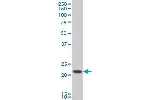 GNPNAT1 polyclonal antibody (A01), Lot # 051116JC01 Western Blot analysis of GNPNAT1 expression in HeLa . (GNPNAT1 抗体  (AA 1-90))