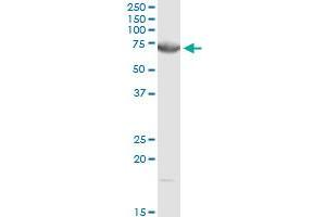DMPK MaxPab rabbit polyclonal antibody. (DMPK 抗体  (AA 1-629))