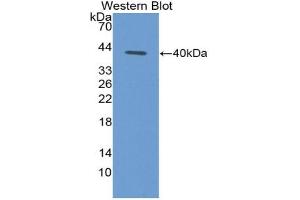Western blot analysis of the recombinant protein. (CCL4L1 抗体  (AA 24-92))