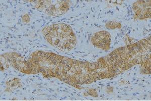 ABIN6266597 at 1/100 staining Human uterus tissue by IHC-P. (MMP7 抗体  (C-Term))
