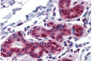 Human Breast: Formalin-Fixed, Paraffin-Embedded (FFPE) (YAP1 抗体  (AA 53-162))