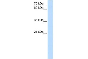 WB Suggested Anti-ZKSCAN1 Antibody Titration:  5.