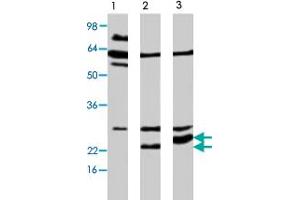 Western blot analysis of extract from Neuro 2a cells, using APH1A polyclonal antibody  . (APH1A 抗体)