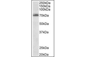 Staining of Jurkat lysate (35µg protein in RIPA buffer) using TSPYL2 antibody at 0. (TSPY-Like 2 抗体  (Internal Region))
