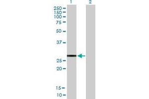 Western Blot analysis of KCNIP2 expression in transfected 293T cell line by KCNIP2 MaxPab polyclonal antibody. (KCNIP2 抗体  (AA 1-270))