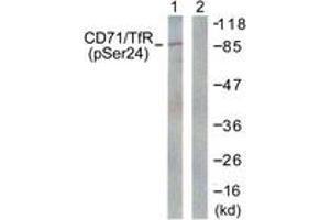 Western blot analysis of extracts from 293 cells treated with PMA 125ng/ml 30' , using CD71/TfR (Phospho-Ser24) Antibody. (Transferrin Receptor 抗体  (pSer24))