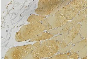 Immunohistochemistry (IHC) image for anti-Protein tyrosine Phosphatase, Non-Receptor Type 1 (PTPN1) (N-Term) antibody (ABIN6264512)