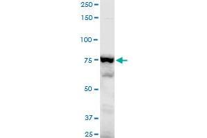 ADD3 polyclonal antibody (A01), Lot # CHI0060725QCS1. (ADD3 抗体  (AA 462-560))