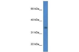 Western Blot showing HSDL1 antibody used at a concentration of 1 ug/ml against HCT15 Cell Lysate (HSDL1 抗体  (N-Term))