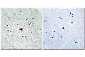 Immunohistochemical analysis of paraffin-embedded human brain tissue using MAPKAPK2 (Phospho-Ser272) antibody (left)or the same antibody preincubated with blocking peptide (right). (MAPKAP Kinase 2 抗体  (pSer272))