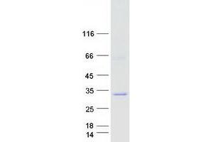 Western Blotting (WB) image for N-Acetyltransferase 15 (NAT15) (Transcript Variant 2) protein (Myc-DYKDDDDK Tag) (ABIN2726736)