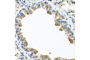Immunohistochemistry of paraffin-embedded mouse lung using SERPINA3 antibody (ABIN5970399) at dilution of 1/100 (40x lens). (SERPINA3 抗体)