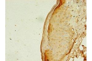 Immunohistochemistry of paraffin-embedded human skin tissue using ABIN7144485 at dilution of 1:100 (APAF1 抗体  (AA 104-415))