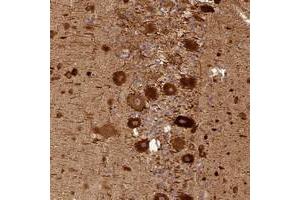 Immunohistochemical staining of human cerebellum with BCDIN3D polyclonal antibody  shows strong cytoplasmic positivity in purkinje cells at 1:50-1:200 dilution. (BCDIN3D 抗体)