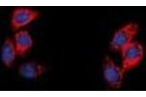 Immunofluorescent analysis of NPY5R staining in A549 cells. (NPY5R 抗体)
