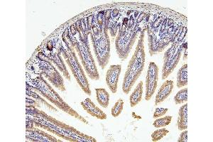 IHC analysis of RNF169 using anti-RNF169 antibody (ABIN6719530). (RNF169 抗体  (AA 311-708))
