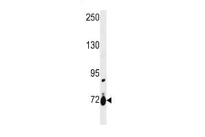 SLC28A1 Antibody (Center) (ABIN1881811 and ABIN2843229) western blot analysis in ZR-75-1 cell line lysates (35 μg/lane). (SLC28A1 抗体  (AA 381-409))
