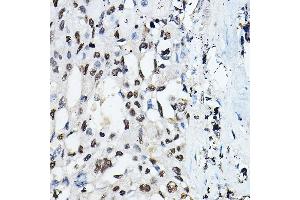 Immunohistochemistry (IHC) image for anti-CCAAT/enhancer Binding Protein (C/EBP), alpha (CEBPA) (AA 1-205) antibody (ABIN6138380)