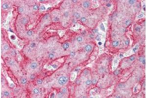 Human Liver (formalin-fixed, paraffin-embedded) stained with ENPP1 antibody ABIN337063 at 2. (ENPP1 抗体  (AA 915-925))