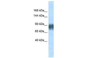 Western Blot showing Avil antibody used at a concentration of 1. (Advillin 抗体  (N-Term))