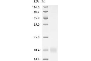 (Tris-Glycine gel) Discontinuous SDS-PAGE (reduced) with 5 % enrichment gel and 15 % separation gel.