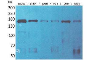 Western Blotting (WB) image for anti-Sterol Carrier Protein 2 (SCP2) (Internal Region) antibody (ABIN3187668) (SCP2 抗体  (Internal Region))