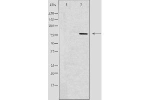 Western blot analysis of extracts from HeLa cells, using GUSB antibody. (Glucuronidase beta 抗体  (Internal Region))