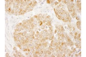 Immunohistochemistry (IHC) image for anti-Insulin Receptor Substrate 1 (IRS1) (AA 1192-1242) antibody (ABIN7448979) (IRS1 抗体  (AA 1192-1242))