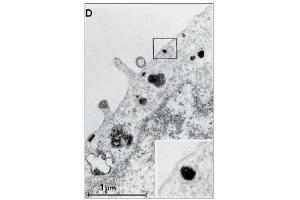 Immunohistochemistry (IHC) image for anti-Epidermal Growth Factor Receptor (EGFR) (Extracellular Domain) antibody (ABIN492657) (EGFR 抗体  (Extracellular Domain))