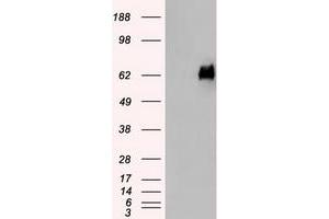 HEK293T cells were transfected with the pCMV6-ENTRY control (Left lane) or pCMV6-ENTRY SILV (Right lane) cDNA for 48 hrs and lysed. (Melanoma gp100 抗体)