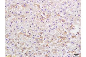 Formalin-fixed and paraffin embedded rat liver labeled with Anti-CKLF Polyclonal Antibody, Unconjugated (ABIN739650) at 1:200, followed by conjugation to the secondary antibody and DAB staining (CKLF 抗体  (AA 1-100))