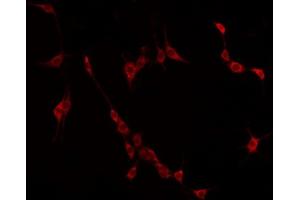 ABIN6275025 staining HuvEc by IF/ICC. (CCDC102B 抗体  (Internal Region))