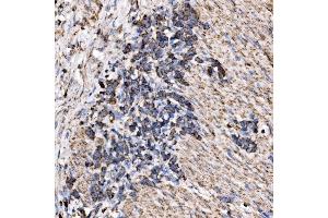 IHC analysis of RPL17 using anti-RPL17 antibody (ABIN7601639). (RPL17 抗体  (AA 40-167))