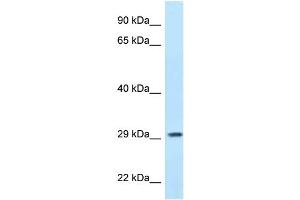 WB Suggested Anti-PPP1R3B Antibody Titration: 1. (PPP1R3B 抗体  (N-Term))