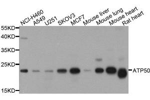 Western blot analysis of extracts of various cell lines, using ATP5O antibody. (ATP5O 抗体  (AA 24-213))
