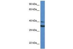 Image no. 1 for anti-NAD(P)H Dehydrogenase, Quinone 1 (NQO1) (AA 111-160) antibody (ABIN6747304) (NQO1 抗体  (AA 111-160))