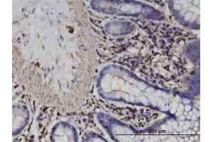 Image no. 1 for anti-Actin-Related Protein T2 (ACTRT2) (AA 209-300) antibody (ABIN599611) (ACTRT2 抗体  (AA 209-300))
