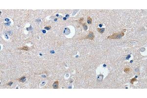 Immunohistochemistry of paraffin-embedded Human brain tissue using GAD2 Polyclonal Antibody at dilution 1:30 (GAD65 抗体)