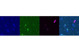 Immunohistochemistry (IHC) image for anti-Somatostatin (SST) antibody (ABIN7455980) (Somatostatin 抗体)