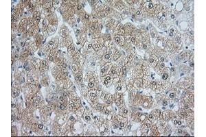 Image no. 2 for anti-Acetyl-CoA Acetyltransferase 2 (ACAT2) antibody (ABIN1496402) (ACAT2 抗体)