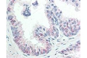 Immunohistochemistry (IHC) image for anti-V-Akt Murine Thymoma Viral Oncogene Homolog 1 (AKT1) (Ser473) antibody (ABIN400784) (AKT1 抗体  (Ser473))