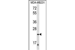 Western blot analysis in MDA-MB231 cell line lysates (35ug/lane). (PEX11A 抗体  (AA 137-165))