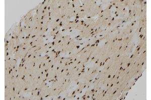 ABIN6279207 at 1/100 staining Mouse heart tissue by IHC-P. (Calcineurin B 抗体  (N-Term))