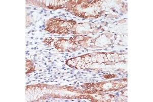 Immunohistochemistry of paraffin-embedded human stomach using Lysozyme (Lysozyme (LYZ)) antibody (ABIN6133802, ABIN6143409, ABIN6143412 and ABIN6217538) at dilution of 1:100 (40x lens). (LYZ 抗体  (AA 1-100))