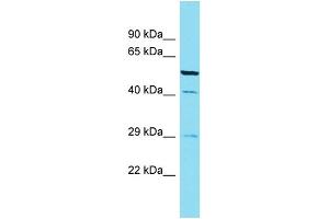 Western Blotting (WB) image for anti-Calcium Binding Protein 4 (CABP4) (C-Term) antibody (ABIN2789662) (CABP4 抗体  (C-Term))