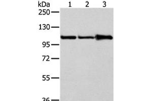 Western Blot analysis of A431, 231 and NIH/3T3 cell using AP2A1 Polyclonal Antibody at dilution of 1/250 (alpha Adaptin 抗体)