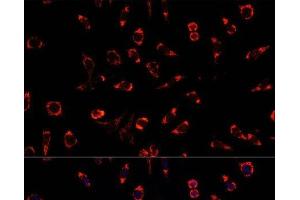 Immunofluorescence analysis of L929 cells using PAH Polyclonal Antibody at dilution of 1:100. (Phenylalanine Hydroxylase 抗体)
