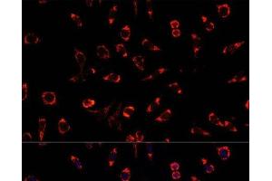 Immunofluorescence analysis of L929 cells using PAH Polyclonal Antibody at dilution of 1:100. (Phenylalanine Hydroxylase 抗体)