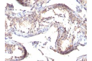 Formalin-fixed, paraffin-embedded human Testicular Carcinoma stained with TGF alpha Mouse Monoclonal Antibody (MF9) (TGFA 抗体  (C-Term))